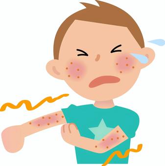 アトピー性皮膚炎の方が掻くと皮膚がすぐに壊れてしまうのは何故か？