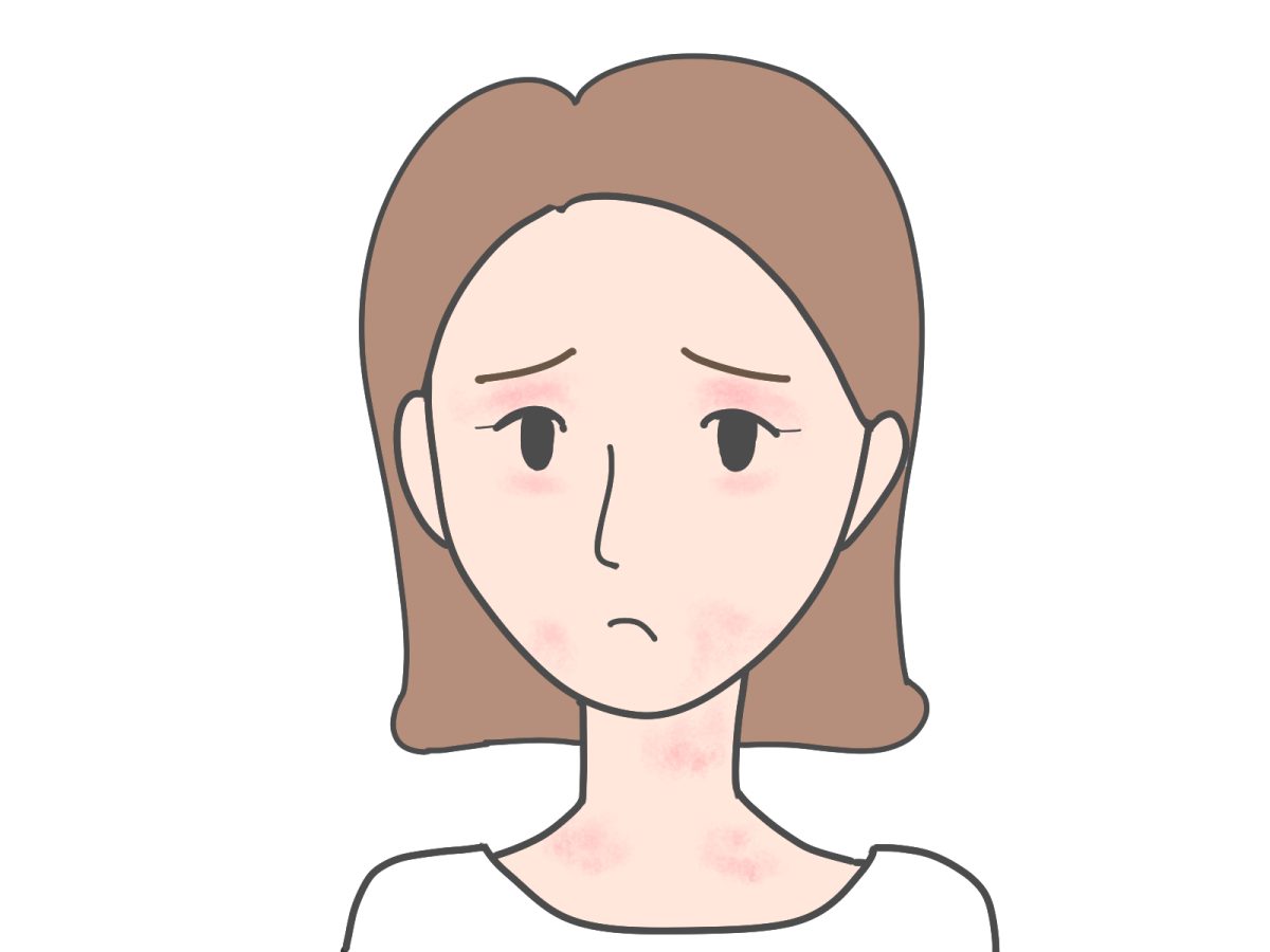 顔や首にアトピーの症状が集中する原因は？