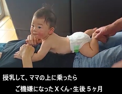 乳児のアトピー生後５ヶ月　ミスター✕君