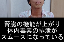 アトピー・ケアによる尿の変化